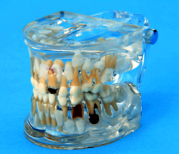 Orthodontic Pathology Models