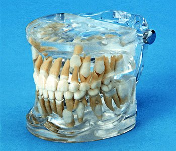 orthodontic model mixed dentition