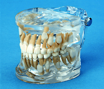 Orthodontic Discussions Model 9 Year Old