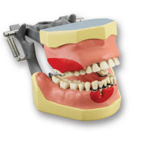 Dental Surgery Bone Graft Drilling Gum Suture