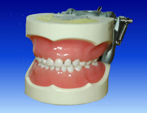 Primary Dentition Model