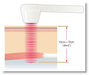 Quantum Terraquant Laser Therapy TerraQuant System - Low Level Laser Quantum