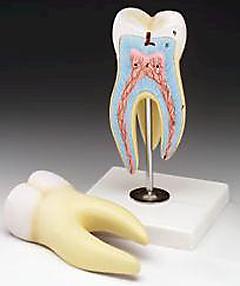 Molar Root Canal Cavities