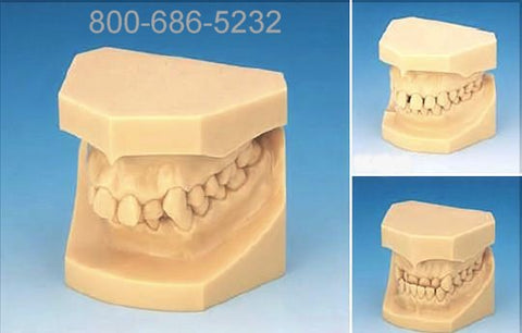 Malocclusion Models