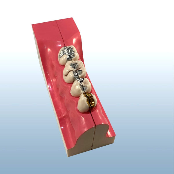 Endodontic Teeth Disease Pathology Model – Buyamag INC