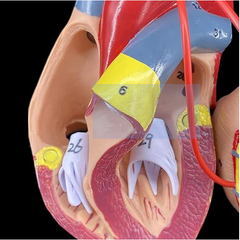 heart bypass model