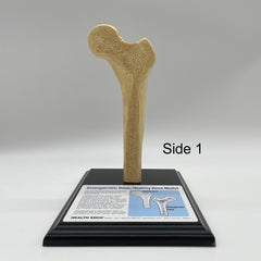 osteoporosis hip Model