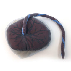 placenta circulation Amnion Chorion Membranes model