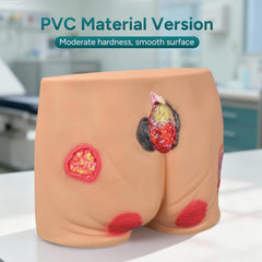 buttocks wound ulcer sores pressure model