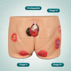 buttocks-pressure-wound-ulcer-sores-model