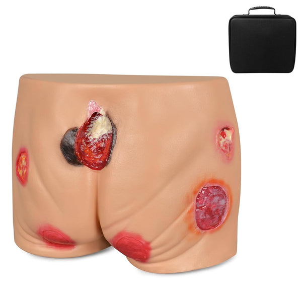 buttocks pressure wound ulcer sores model