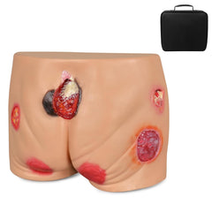 buttocks pressure wound ulcer sores model