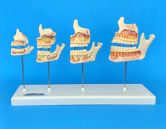 dentition development model