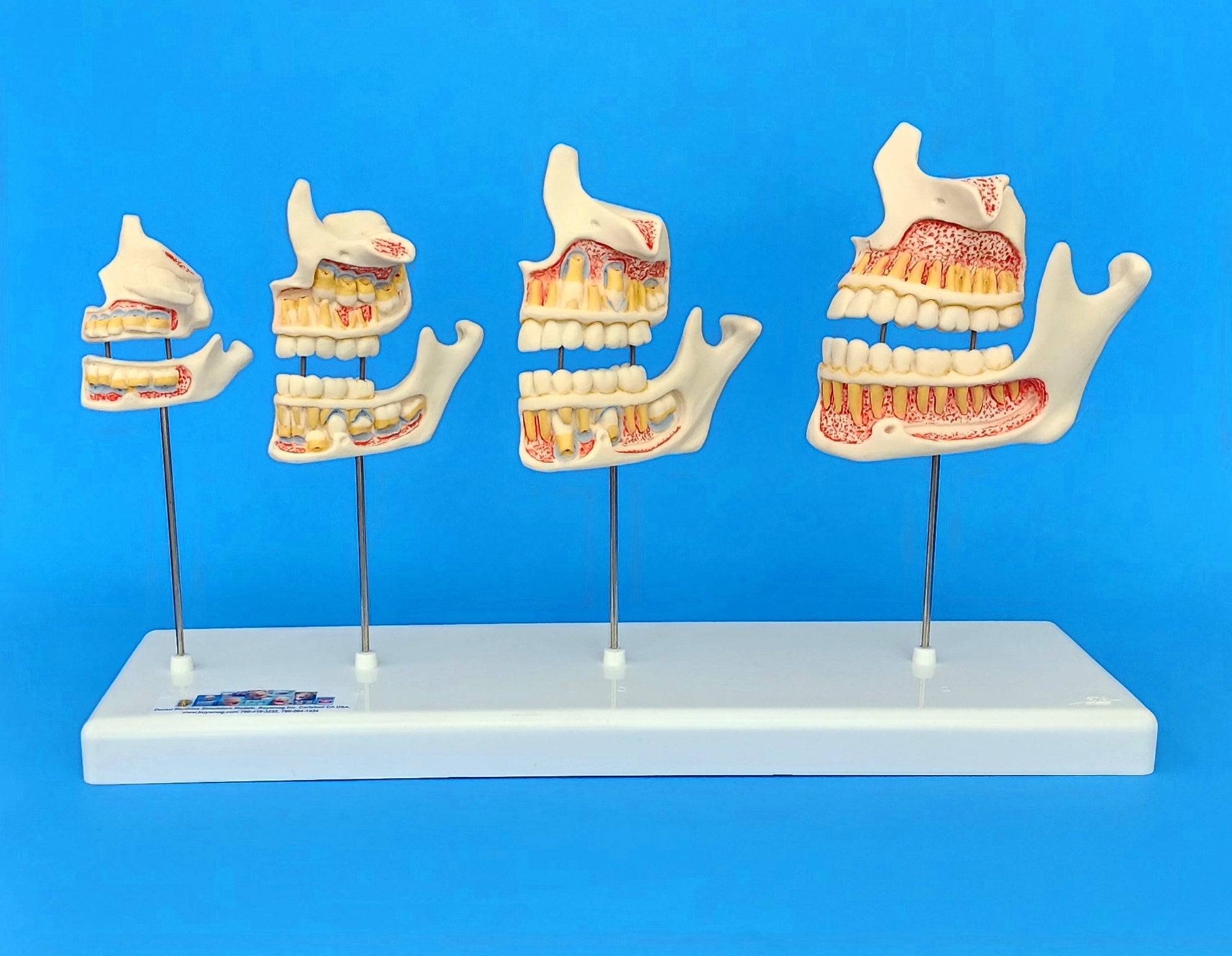 Child Teeth Dentition Development Model | – Buyamag INC