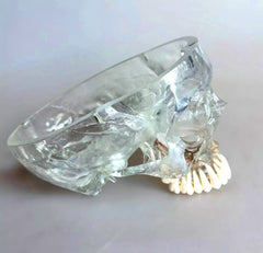 dental Maxillary Teeth Sinuses model
