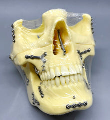neurosurgery dental skull bone injuries model