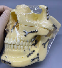 dental skull craniofacial injuries model