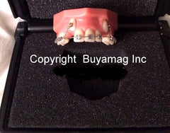 cuspid lok orthodontic model