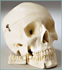 dental teeth impacted wisdom extraction skull