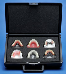 dental models storage plastic boxes carrying box