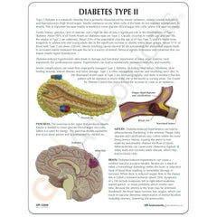 Diabetes Model Display Disease GPI Anatomical