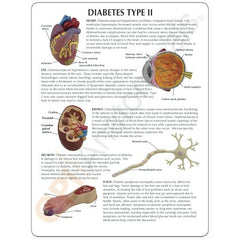 diabetic model
