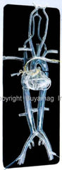 angiogram heart surgery model simulator