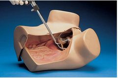 gynecological laparascopic simulator