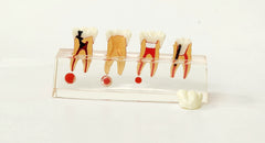 molar endodontic sequence model