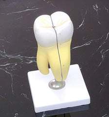 molar cavity model