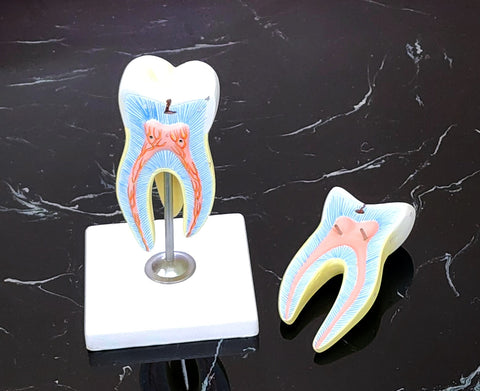 molar tooth cavity model