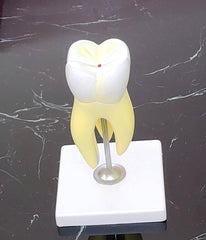 molar tooth model