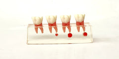 molar treatment sequence model