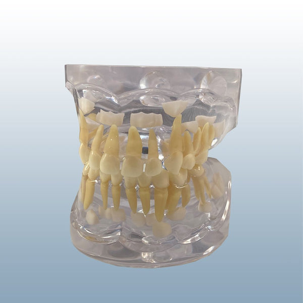 pediatric primary dentition model