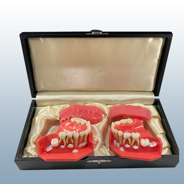 orthodontic teeth eruption pediatric model
