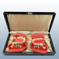 teeth eruption orthodontic models