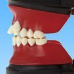 orthodontic wax form