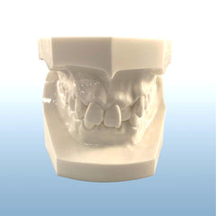 Orthodontic Models Malocclusions Demonstrations Kit of 10 Models Or Individual