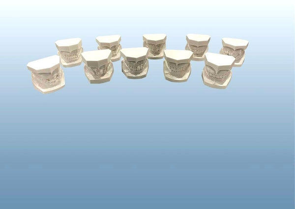 Orthodontic Models Malocclusions Demonstrations Kit of 10 Models Or Individual