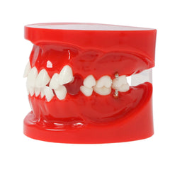 orthodontic training model