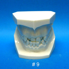 Malocclusion Demonstration models set