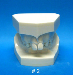 Orthodontic Malocclusion Demonstration model set