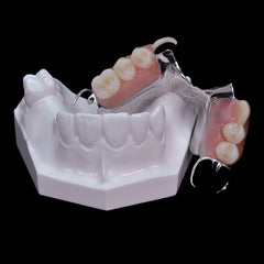 dental partial clasp locator model with framework