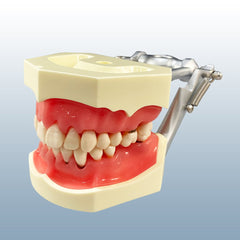 Periodontal hygiene disease model 