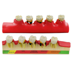 periodontal pathology model