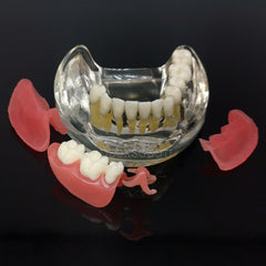 prosthetic implant partial model