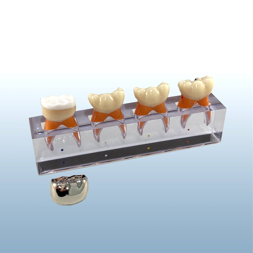 Pulpotomy Model- Molar Steel Crown Buyamag – Buyamag INC