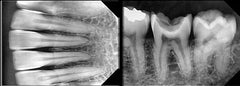 dental x-ray sensor software
