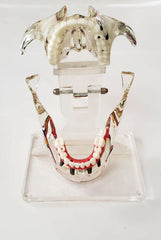 Dental implants bridges veneer model