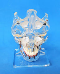 Dental Sinuses Implants Bridge Veneers Models